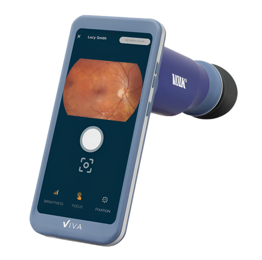 Viva Non-Mydriatic Handheld Retinal Camera
