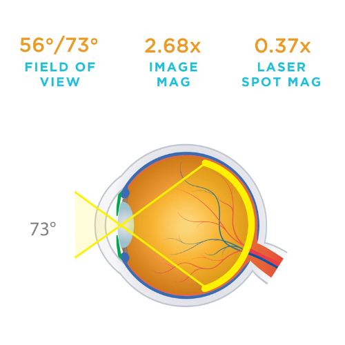 Pan Retinal 2.2 Clear Lens