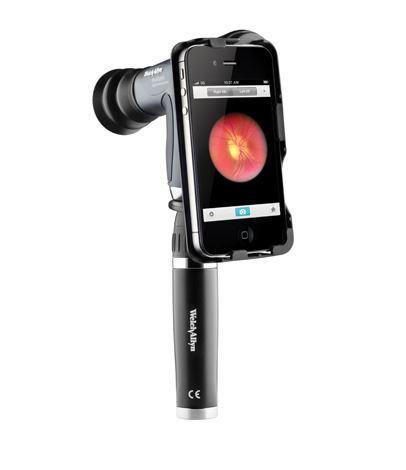 Welch Allyn iExaminer Adapter for the PanOptic Ophthalmoscope - Optics Incorporated