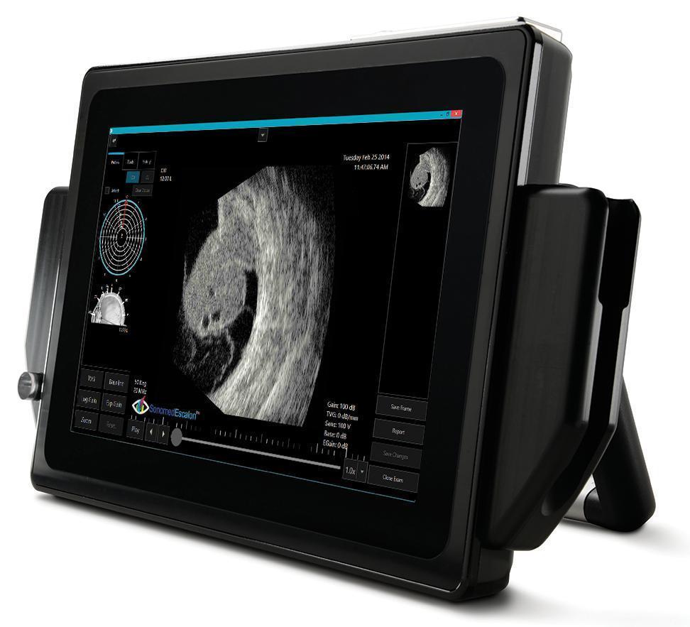 Ultrasound – Optics Incorporated