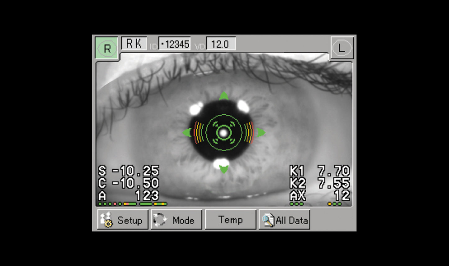 RC-800 Auto-Refractor/Keratometer