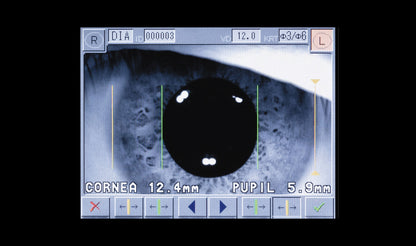 RC-5000 Auto-Refractor/Keratometer