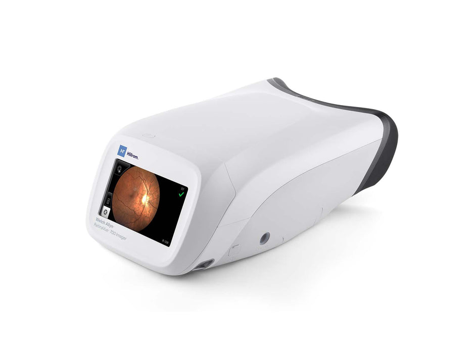 Welch Allyn Retinal Cameras – Optics Incorporated