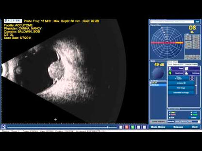 B-Scan Plus