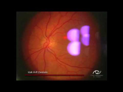 High Resolution Centralis Lens