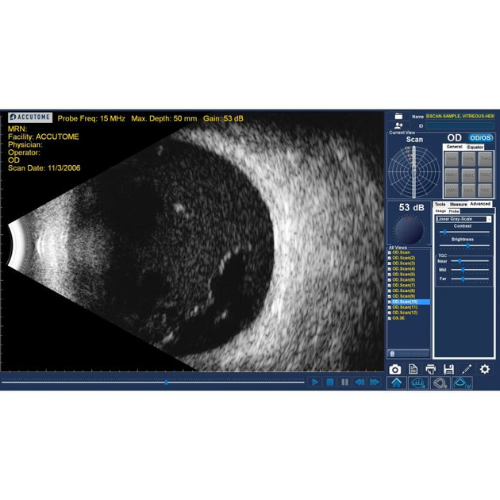 B-Scan Plus