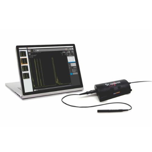 Scanmate A-Scan