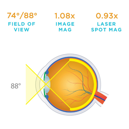 High Resolution Centralis Lens