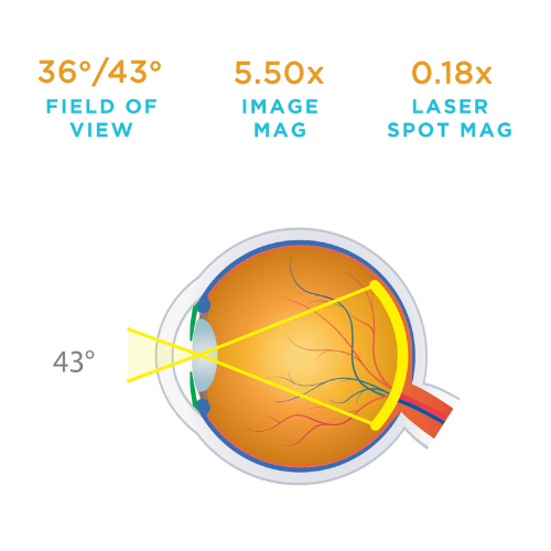Macula Plus 5.5