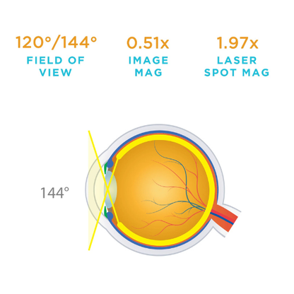 Quadraspheric Lens
