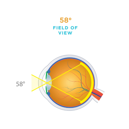 Single Use 20D Lens (10 per Box)