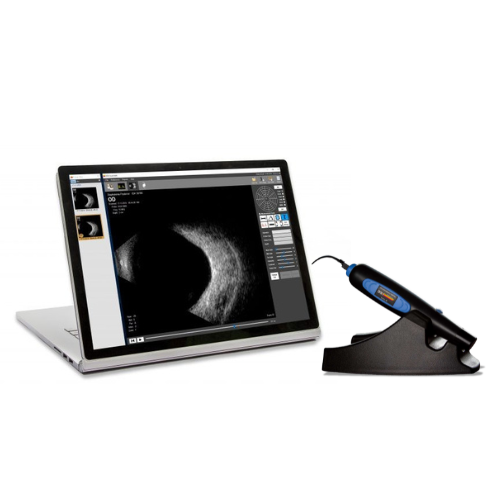 Scanmate B-Scan
