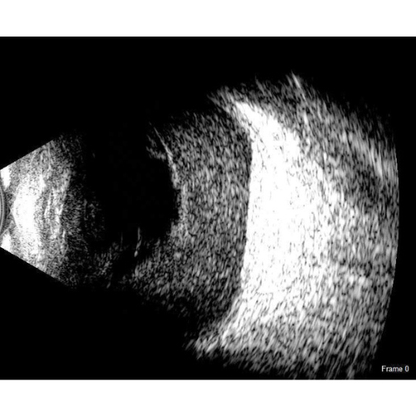 Scanmate B-Scan