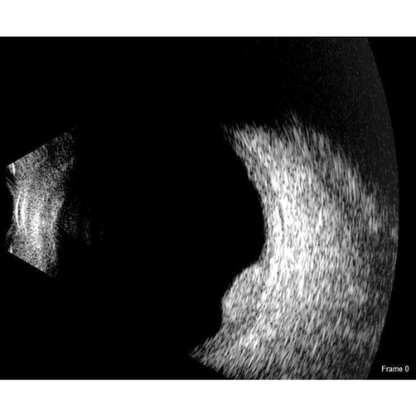 Scanmate B-Scan