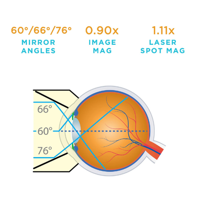 Single Use 3-Mirror Gonio Lens (10 per Box)