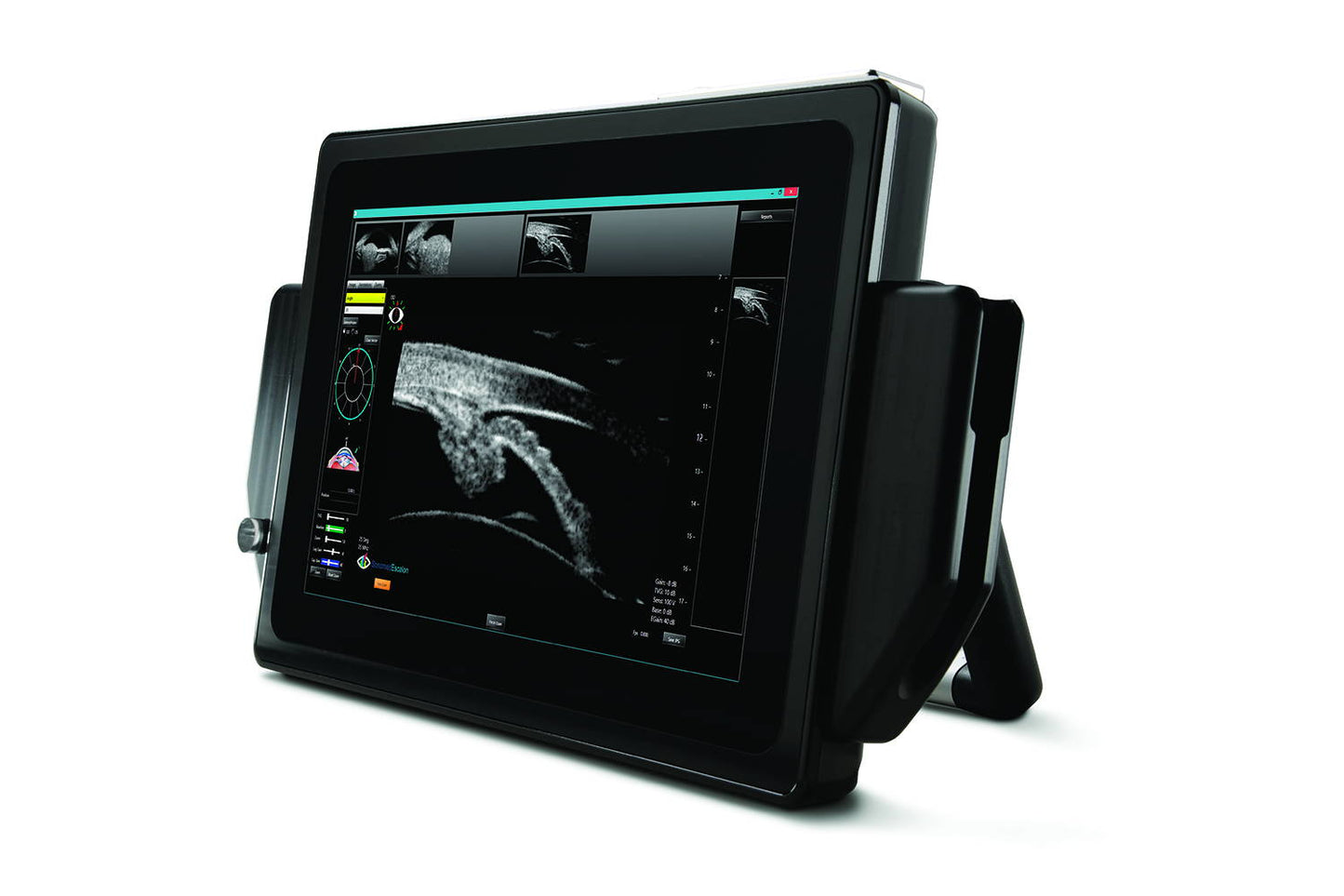 VuPad Portable Ophthalmic Ultrasound