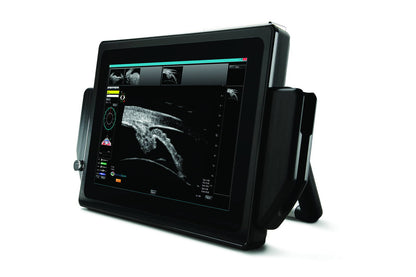 VuPad Portable Ophthalmic Ultrasound