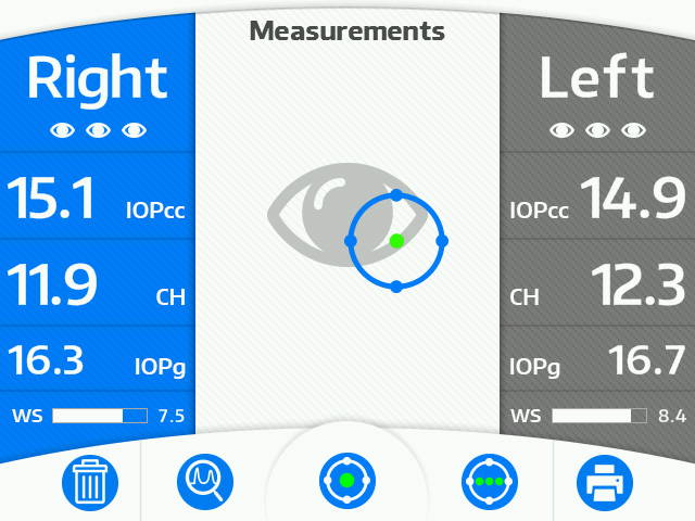 G3 Ocular Response Analyzer