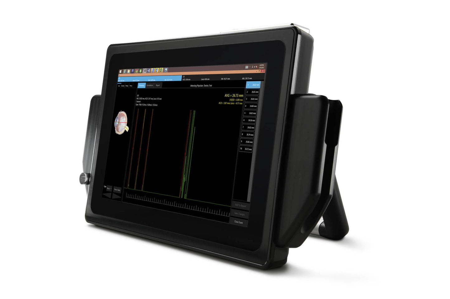 VuPad Portable Ophthalmic Ultrasound