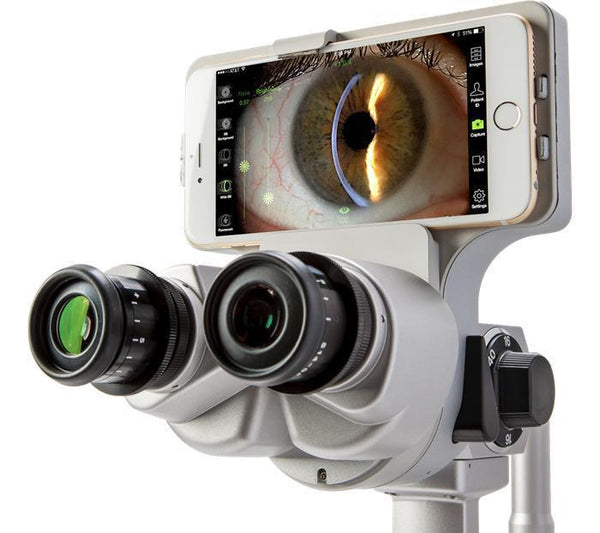 Marco Ion Imaging System - Optics Incorporated