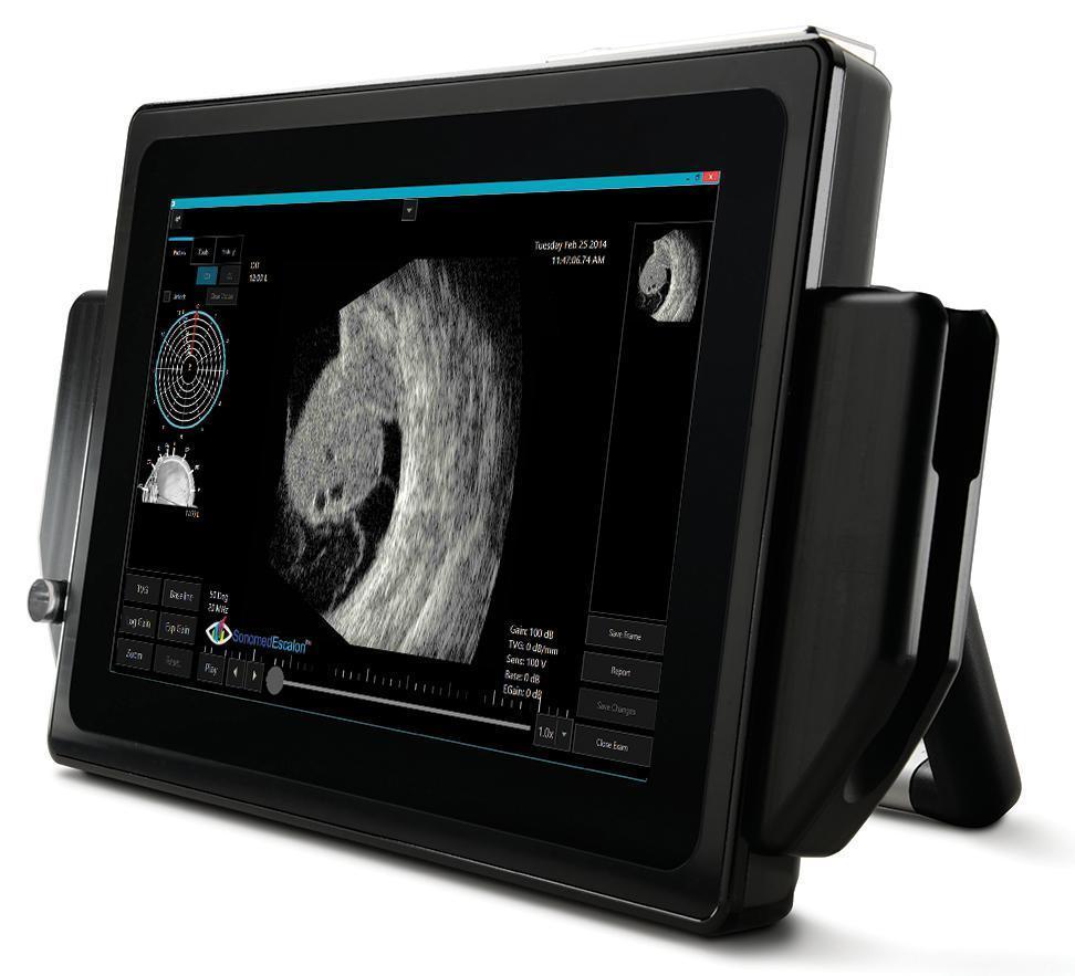 Sonomed Escalon VuPad Portable Ophthalmic Ultrasound - Optics Incorporated